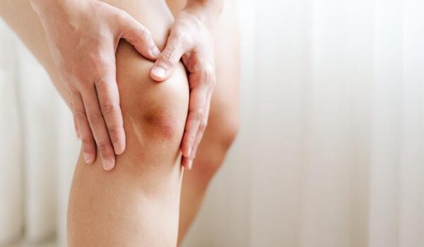 curare la contusione al ginocchio